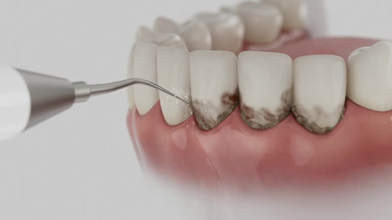 Reliable Teeth Cleaning And Checkup contractor in Harrison County County, OH by Dentist Open Now